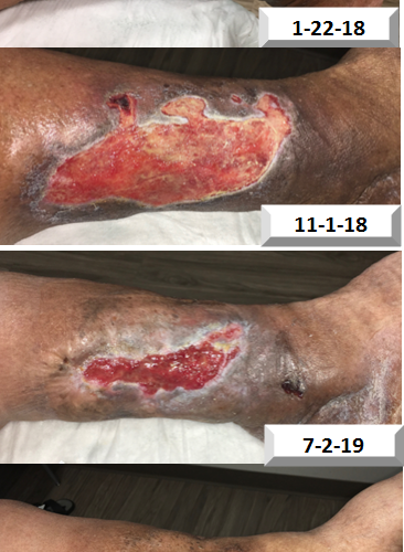 Healing Progress
